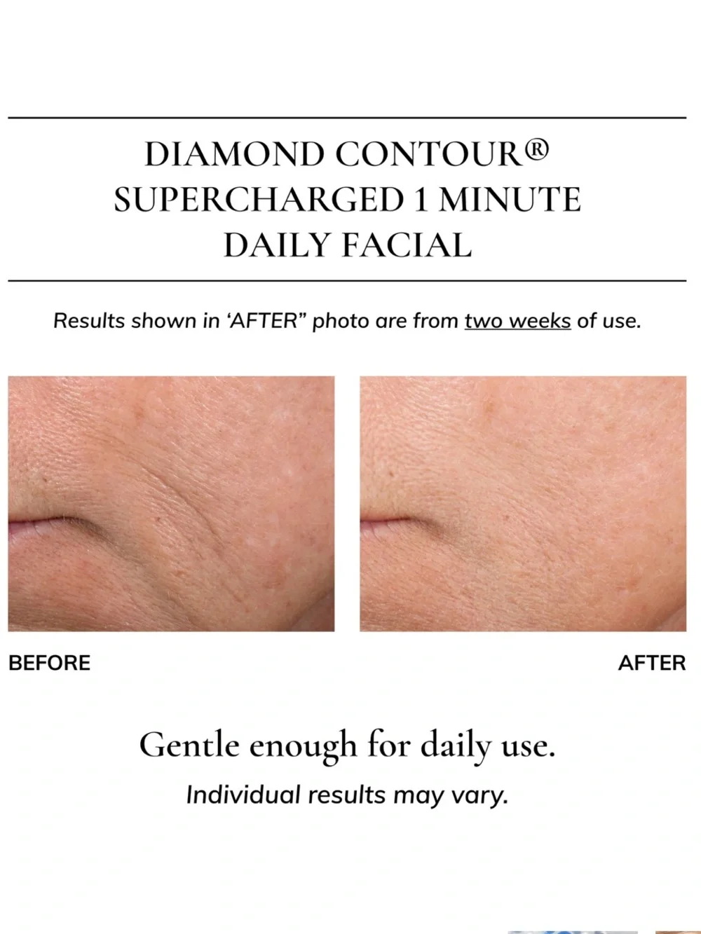 Kaplan MD Diamond Contour 1 Minute Daily Rejuvenating Facial Elixir 1.35/40ml